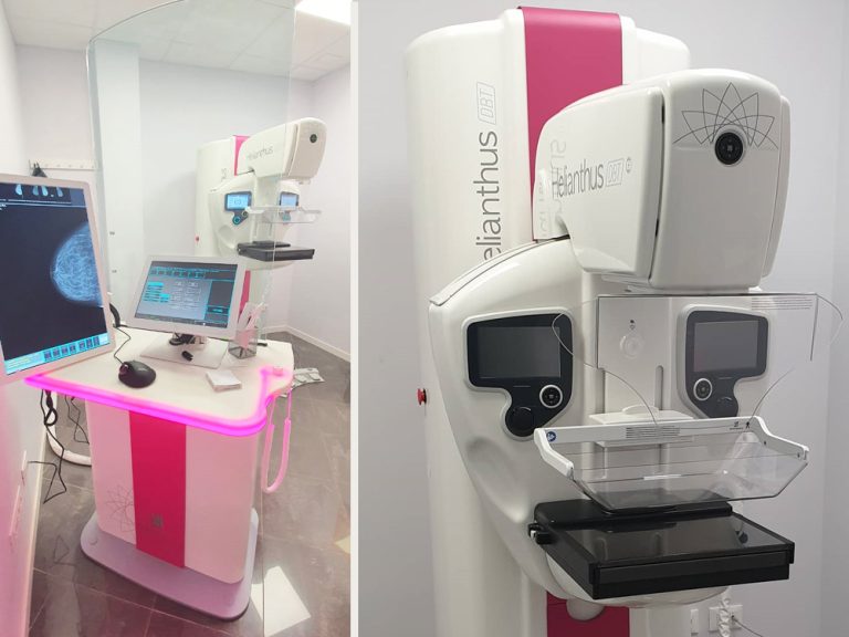 mammografo